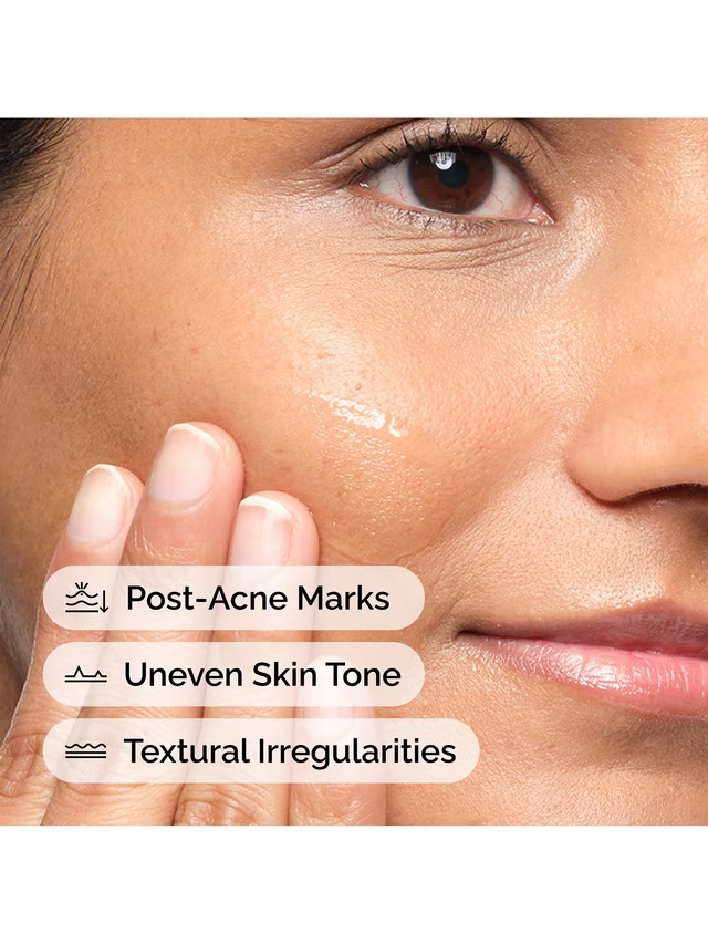The Ordinary. Aloe 2% + Nag 2% Solution 30ml
